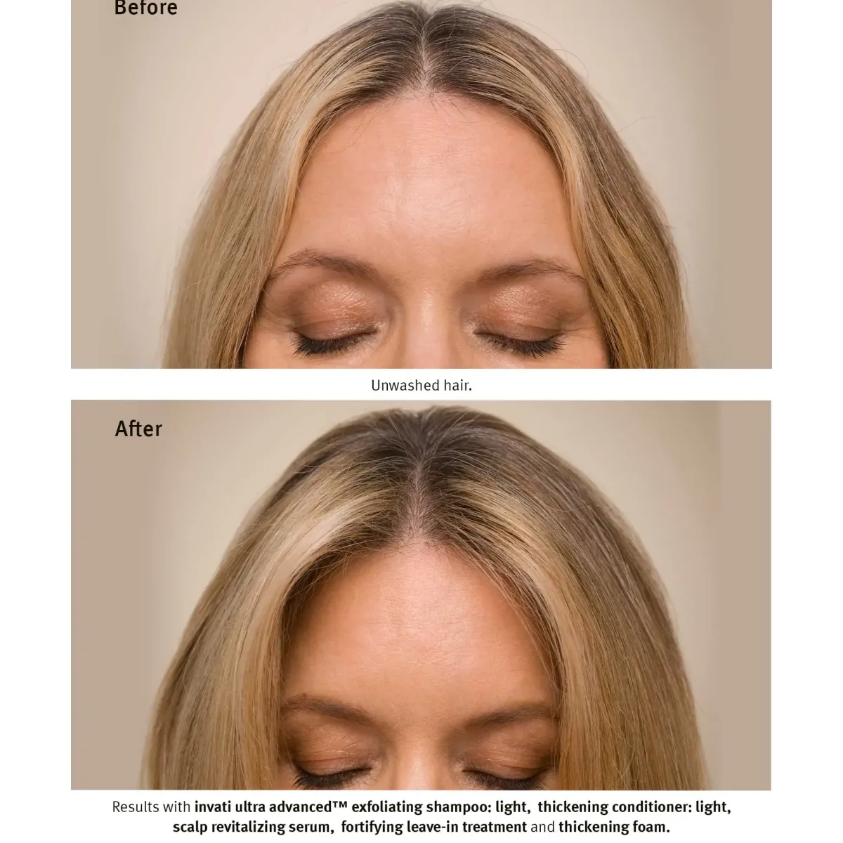 Aveda Soins Du Cuir Chevelu|Sérum Et Huile>Invati Ultra Advanced Revitalizing Scalp Serum