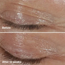 Clinique Soin Des Yeux><noscript><img width=