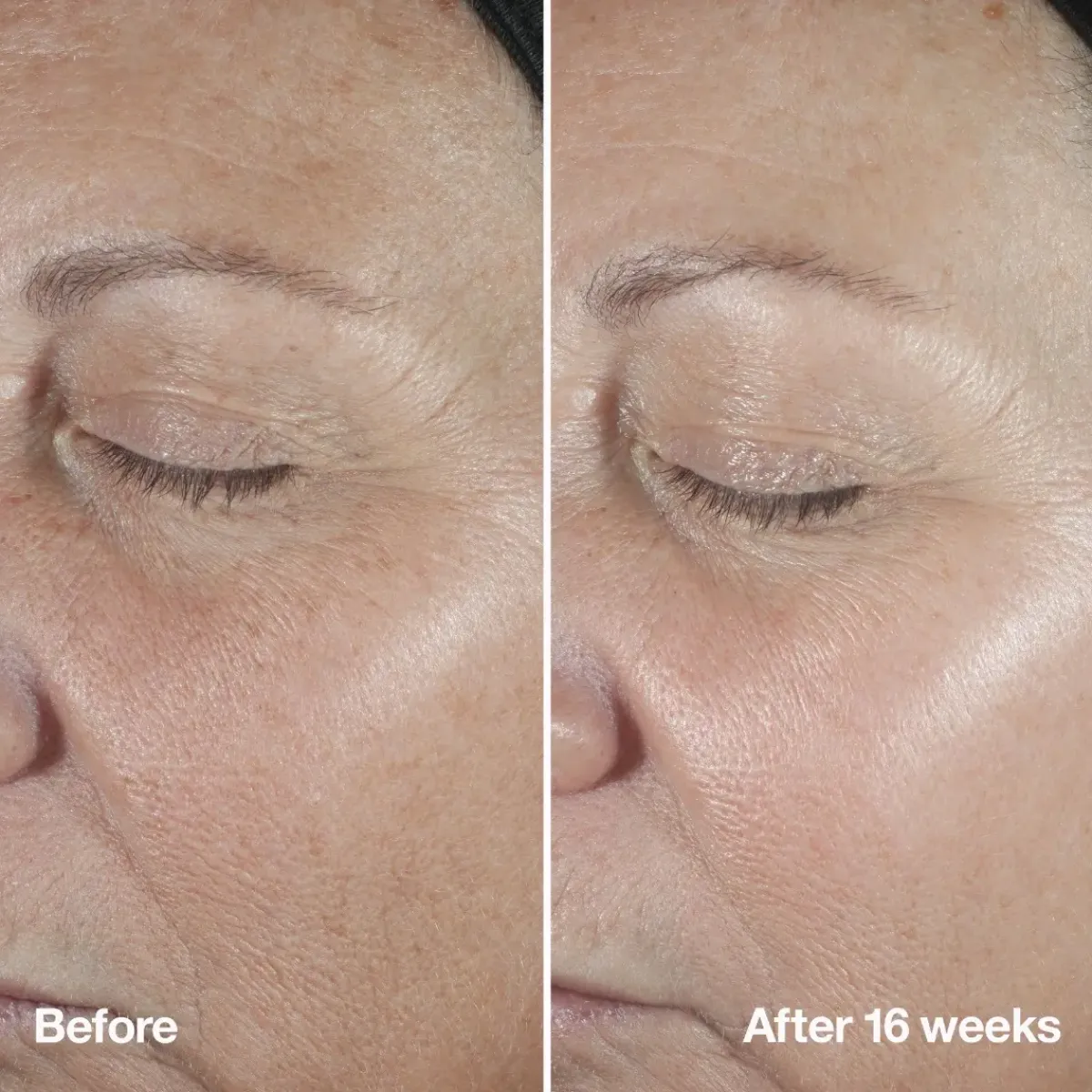 Clinique Serum>Smart Clinical Repair Serum
