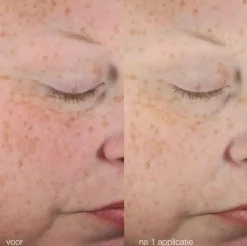 Dermalogica Soin Solaire Visage><noscript><img width=