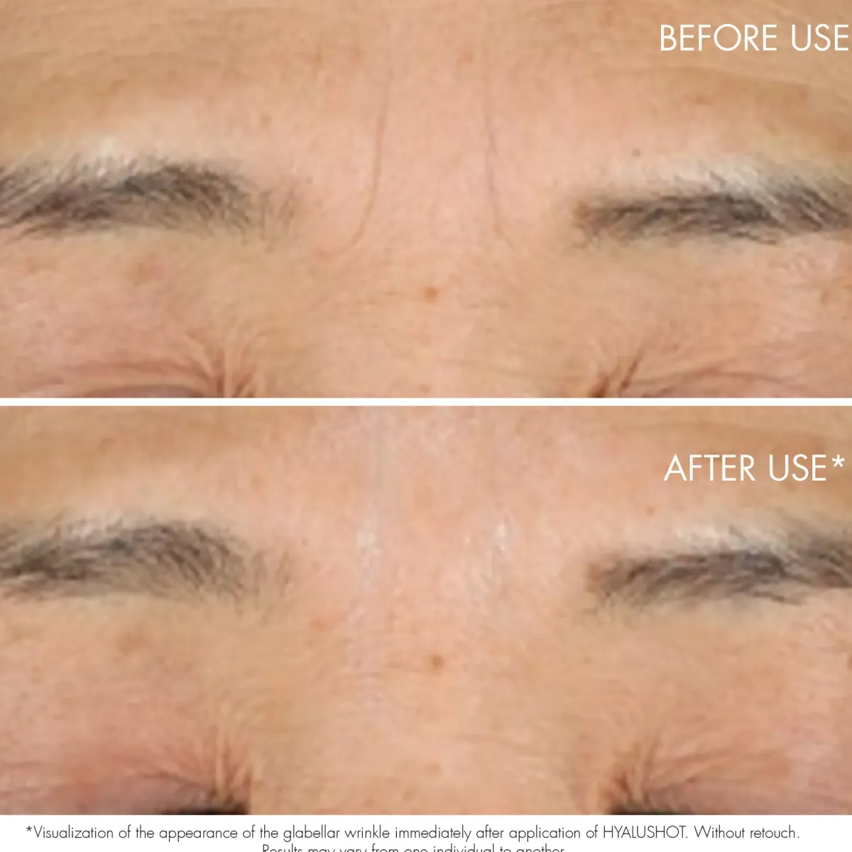 DIOR Serum>Capture Totale Hyalushot