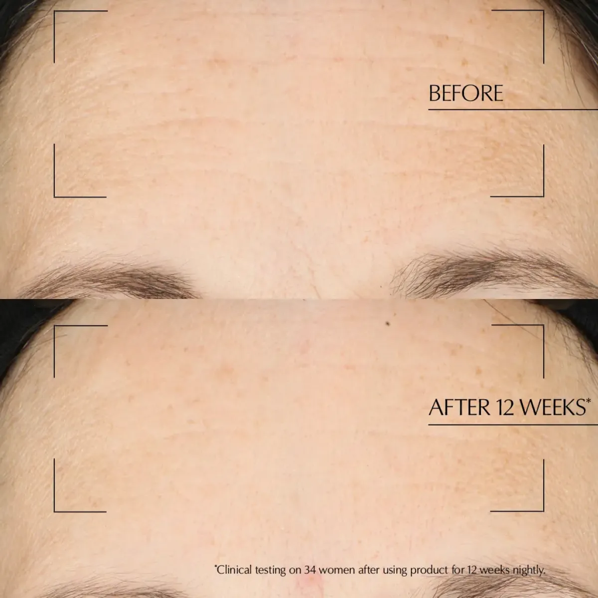 Estée Lauder Crème De Nuit>Estee Lauder Advanced Night Repair Overnight Treatment