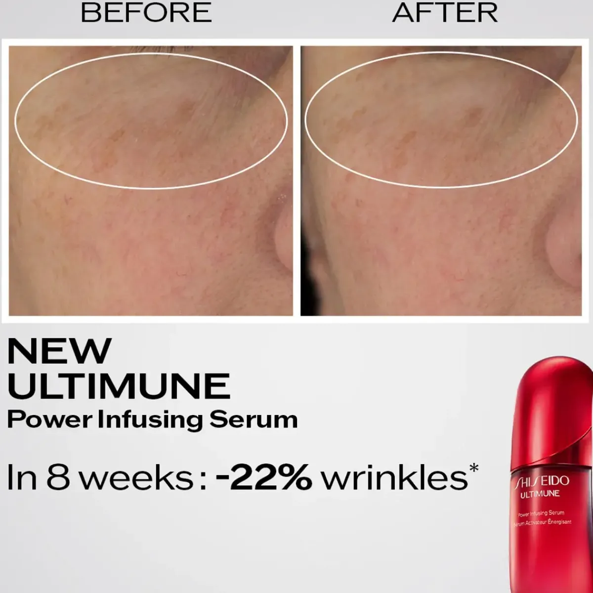 Shiseido Serum>Ultimune Power Infusing Serum